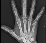 X-Ray, MRI, Medical imaging image